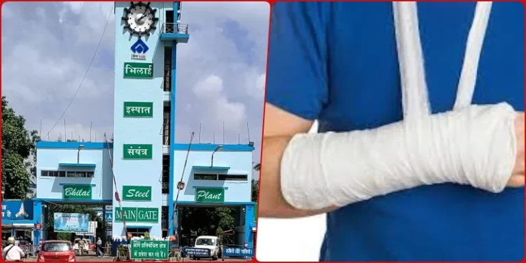 Breaking-News-Accident-in-Bhilai-Steel-Plant-iron-pipe-spilled-laborers-bone-broken-admitted-to-private-hospital-1