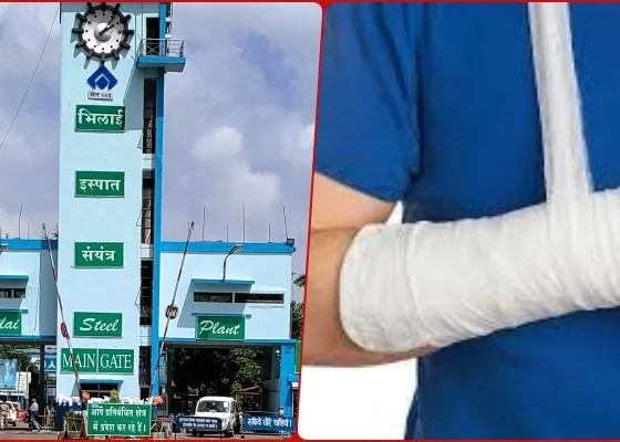 Breaking News: Accident in Bhilai Steel Plant, iron pipe spilled, laborer's bone broken, admitted to private hospital