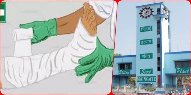 Bhilai-Steel-Plant-accident-worker-injured-serious-injury-to-hands-and-legs