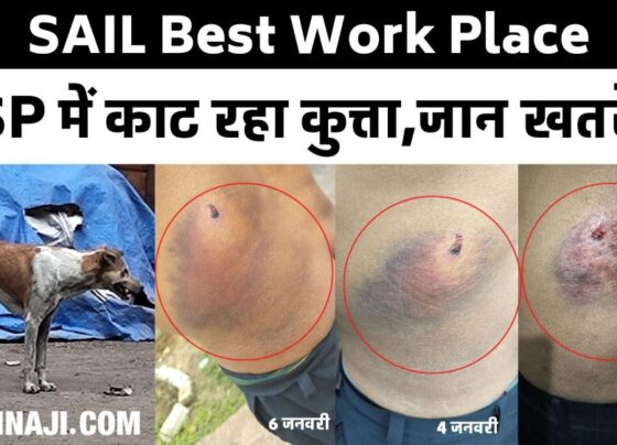 Dog bites workers in Best Work Place Bhilai Steel Plant, infection spreads