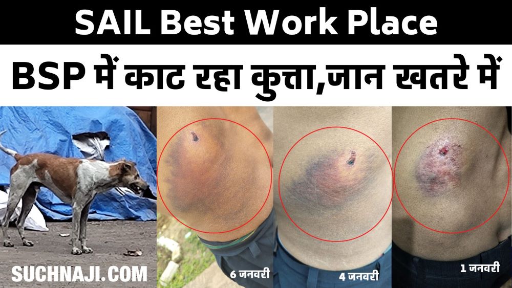 बेस्ट वर्क प्लेस Bhilai Steel Plant में कर्मियों को दौड़ाकर काट रहा कुत्ता, फैला इंफेक्शन