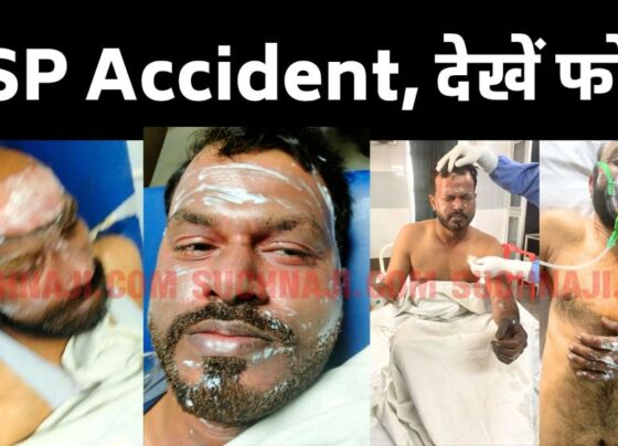 Bhilai Steel Plant: See the shocking photo of 3 workers burnt in the accident