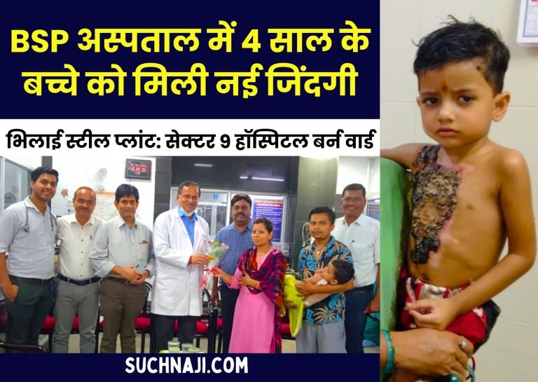 Bhilai-Steel-Plant-Burn-ward-of-Sector-9-Hospital-gave-new-life-to-a-4-year-old-child-skin-grafting-was-successful