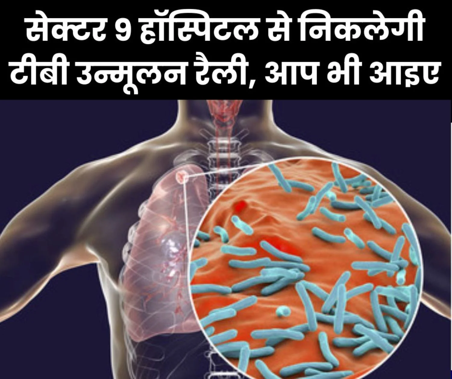 TB eradication rally will start from Sector 9 Hospital, read details
