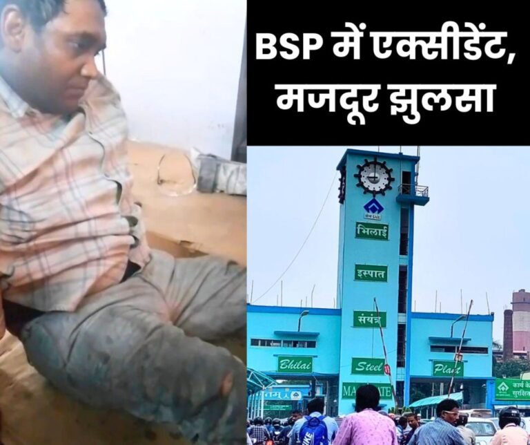 Accident in Bhilai Steel Plant, workers both legs burnt