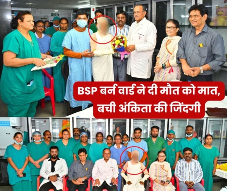Ankita suffered 80% burns in Chhindwara, was treated for 18 days in Nagpur, the burn ward of BSP Sector 9 Hospital saved her life