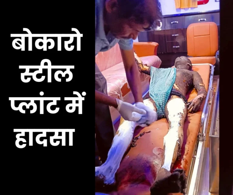 Accident in Bokaro Steel Plant Worker Severely Burnt