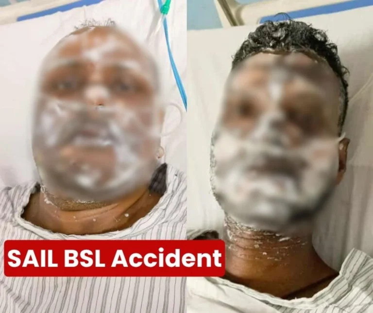 Accident at Bokaro Steel Plant, Two Workers Injured, Admitted to BGH