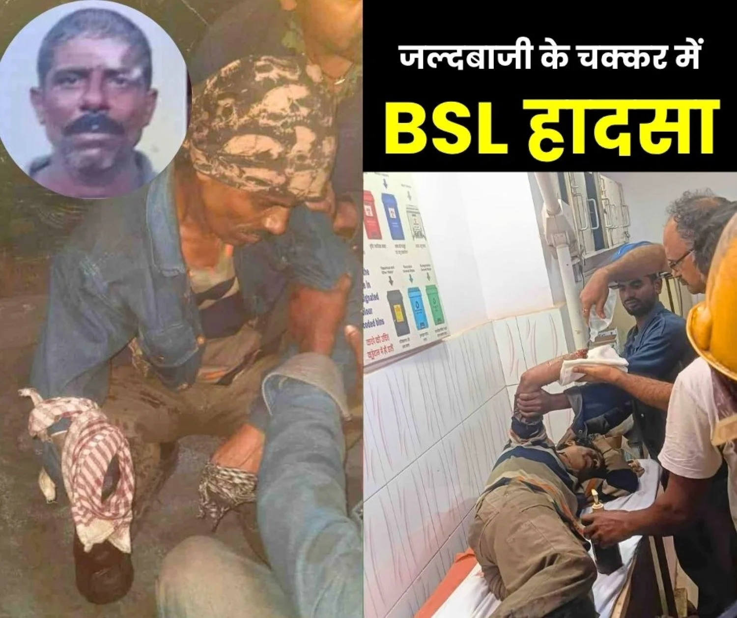 Accident in Bokaro Due to Hurry to go Home Injured Worker Referred from BGH to Apollo Kolkata