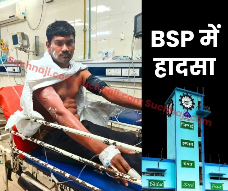 Breaking News Bhilai Steel Plant Accident Contract Worker Suffers Burn Injuries in Coke Oven