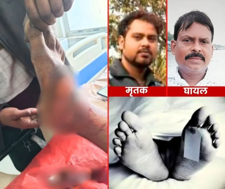 Alloy Steel Plant Durgapur Contract Worker Dies in Accident Labor Leaders Leg Amputated