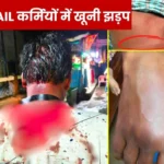 SAIL ISP Violent Clash in two Employees Union Leader Admitted to Hospital, FIR to Be Filed 1
