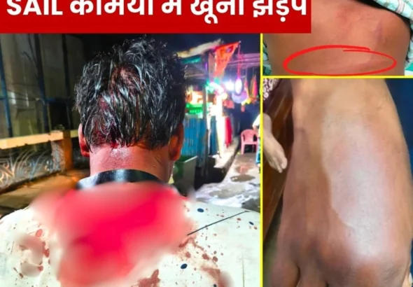 SAIL ISP Violent Clash in two Employees Union Leader Admitted to Hospital, FIR to Be Filed 1