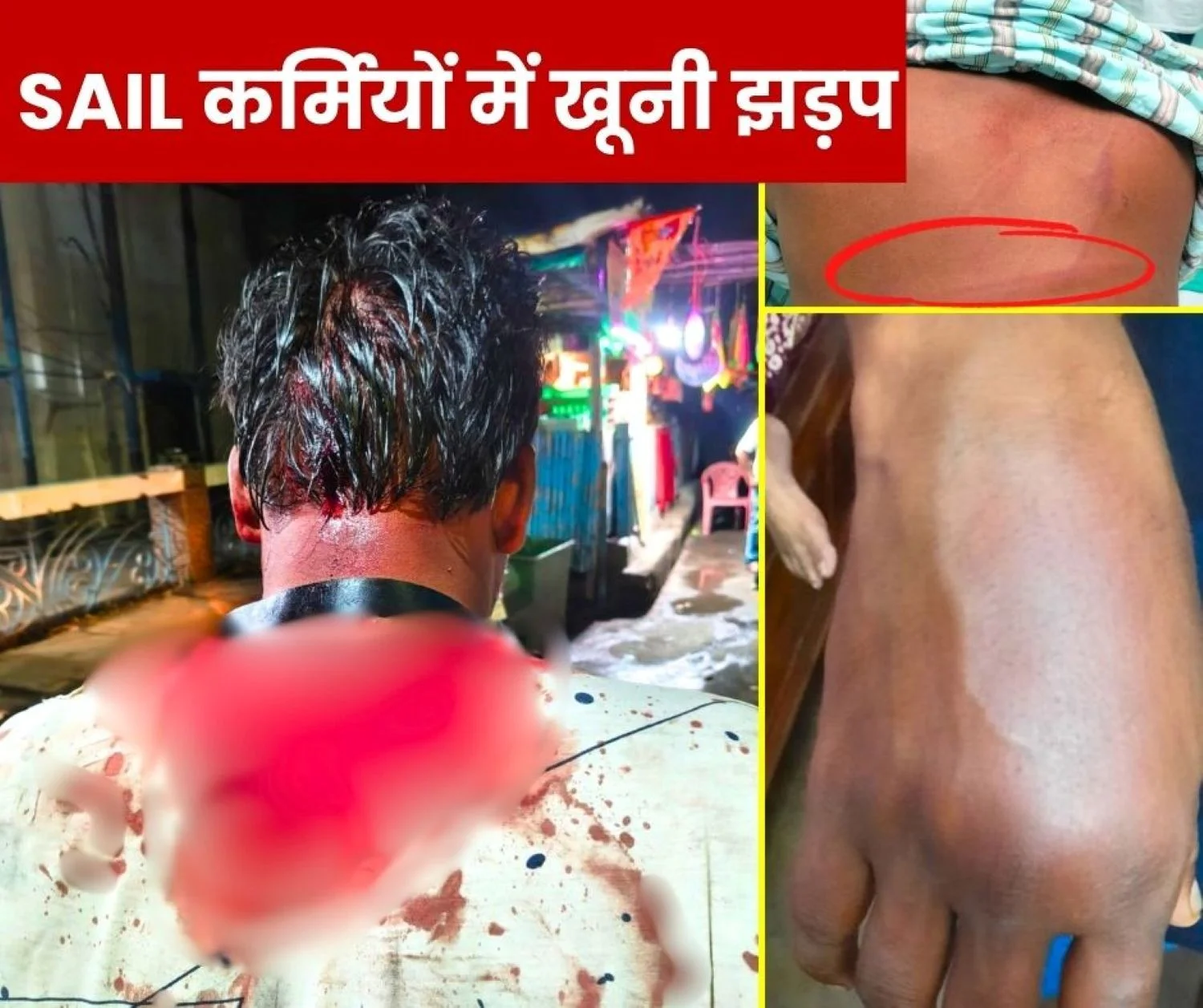 SAIL ISP Violent Clash in two Employees Union Leader Admitted to Hospital, FIR to Be Filed 1