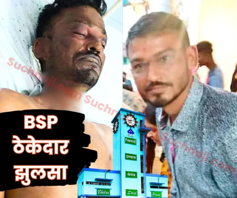 Breaking News Bhilai Steel Plant contractor Sudhanshu Khandelwal Suffers Burn Injuries Under Suspicious Circumstances