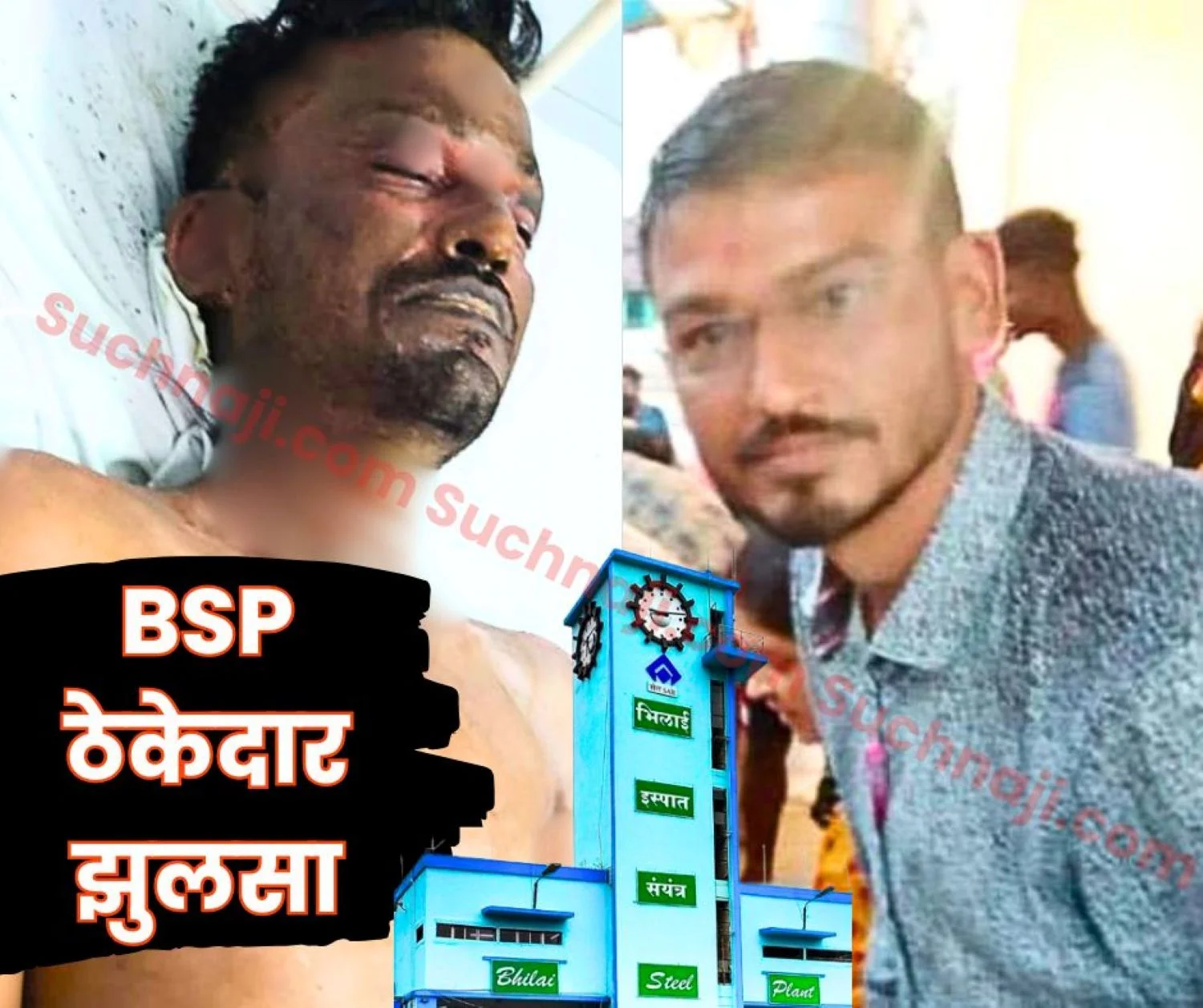 Breaking News Bhilai Steel Plant contractor Sudhanshu Khandelwal Suffers Burn Injuries Under Suspicious Circumstances