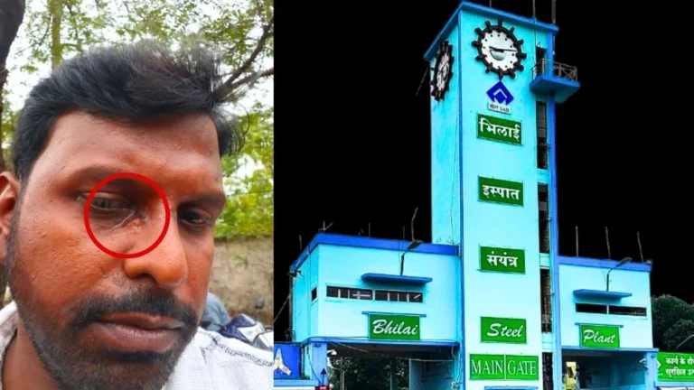 Bhilai Steel Plant Short Circuit in Township Quarters Employee Injured