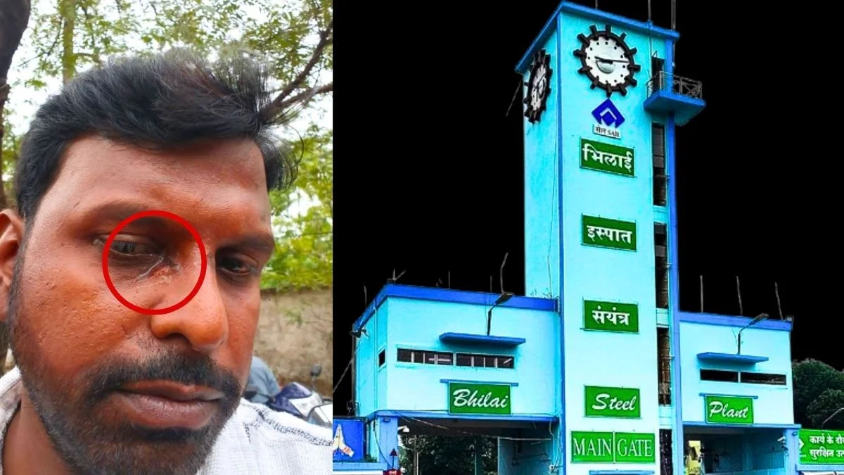 Bhilai Steel Plant Short Circuit in Township Quarters Employee Injured