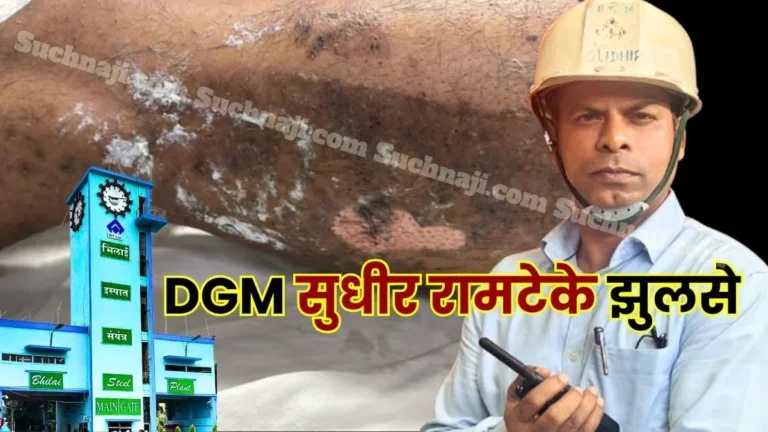 BSP DGM Sudhir Ramteke suffers burns admitted to Sector 9 Hospital 1
